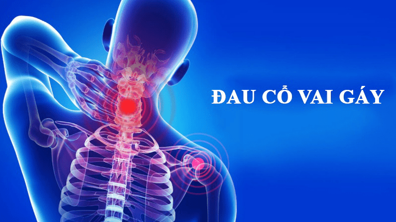 Các biểu hiện đau cổ vai gáy thường gặp