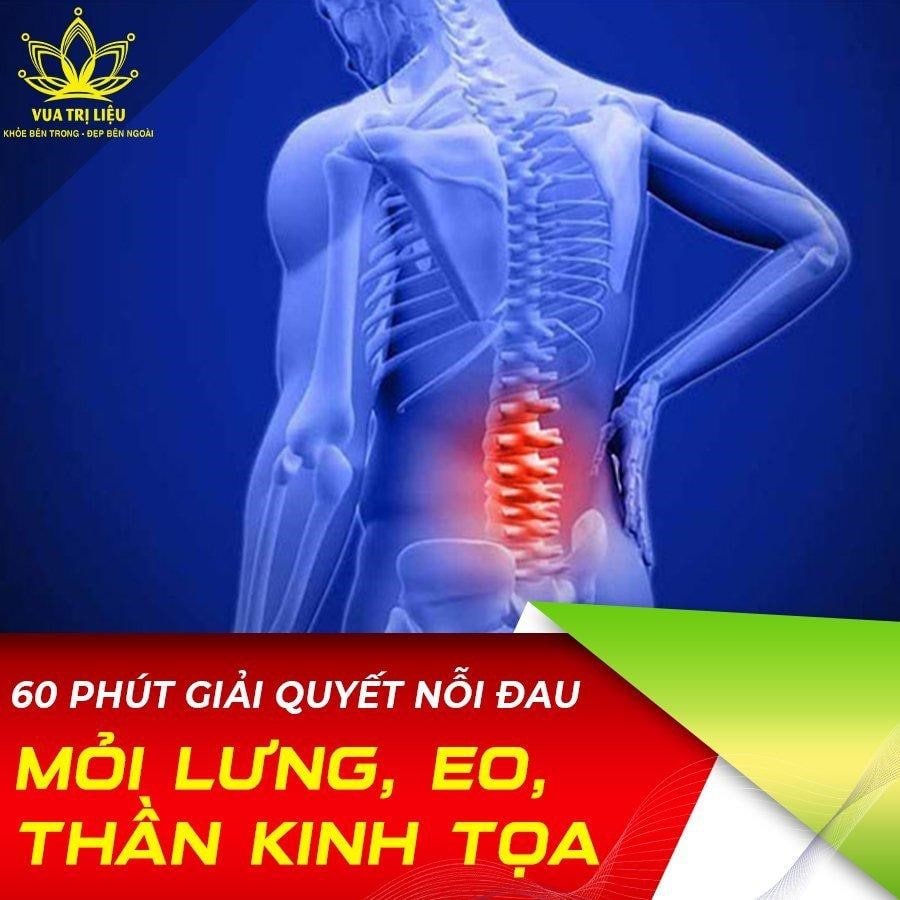 60 phút giải quyết nỗi đau mỏi lưng, eo, thần kinh tọa