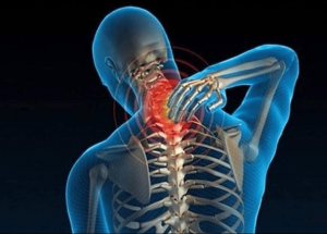 Thoái hóa đốt sống cổ là gì?
